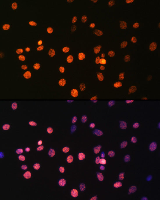 MonoMethyl-Histone H3-R17 Rabbit pAb