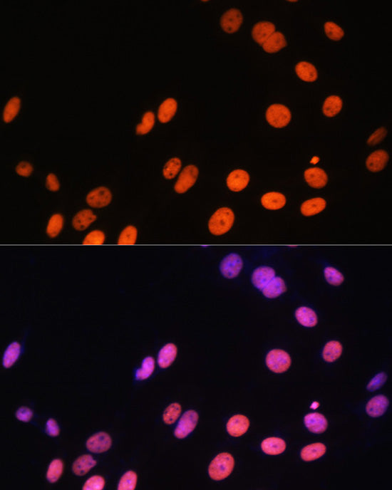 MonoMethyl-Histone H3-R17 Rabbit pAb