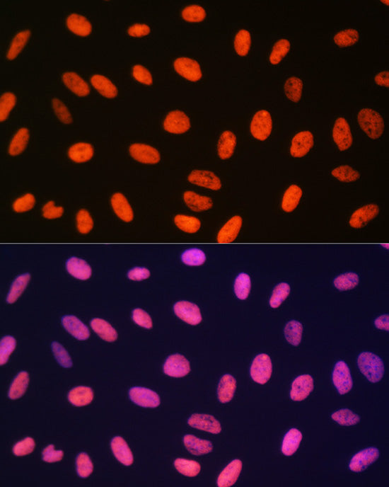 MonoMethyl-Histone H3-R17 Rabbit pAb