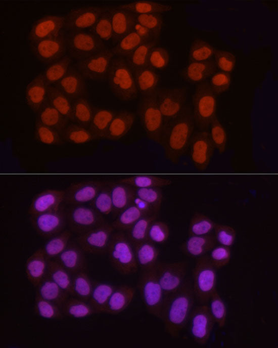 Asymmetric DiMethyl-Histone H3-R2 Rabbit pAb