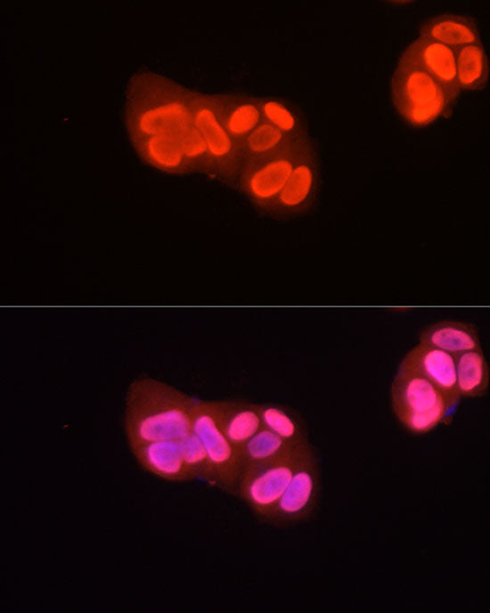 Asymmetric DiMethyl-Histone H3-R2 Rabbit pAb