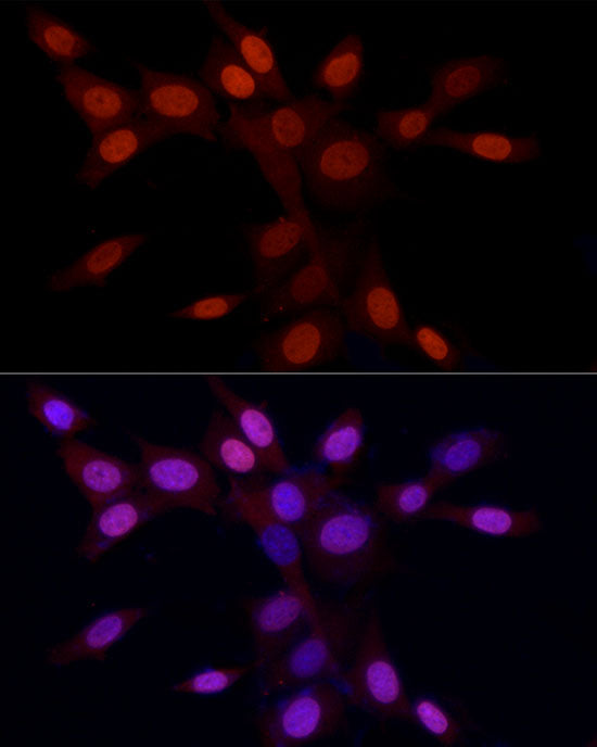 Asymmetric DiMethyl-Histone H3-R2 Rabbit pAb