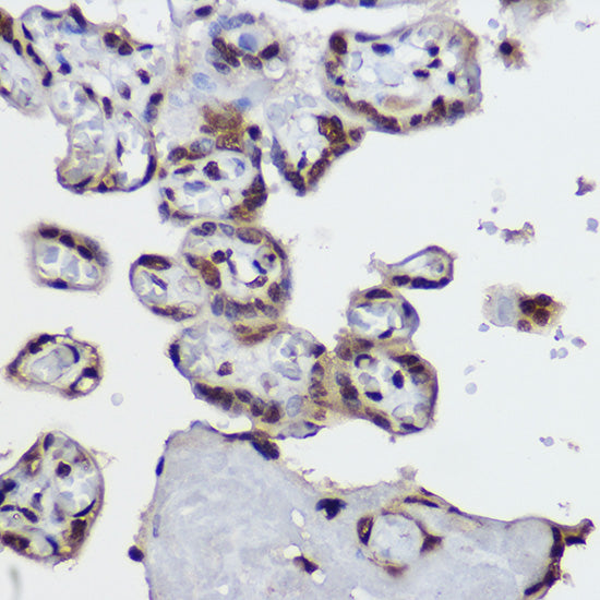 Symmetric DiMethyl-Histone H4-R3 Rabbit pAb