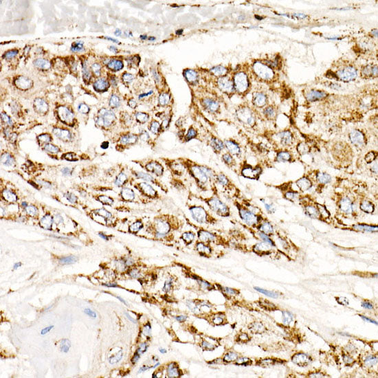 TFAM Rabbit mAb