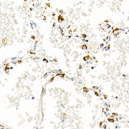 TFAM Rabbit mAb