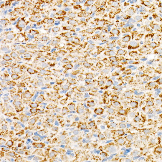 TFAM Rabbit mAb