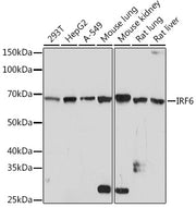 IRF6 Rabbit mAb