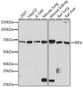 IRF6 Rabbit mAb