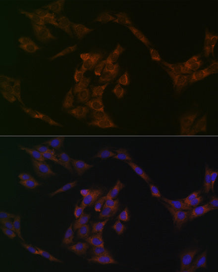 IRF6 Rabbit mAb