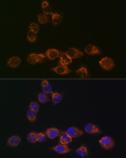 IRF6 Rabbit mAb