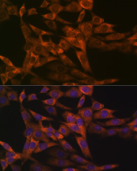 IRF6 Rabbit mAb