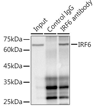 IRF6 Rabbit mAb