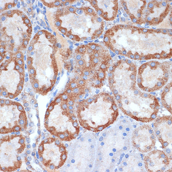 CLPP Rabbit mAb