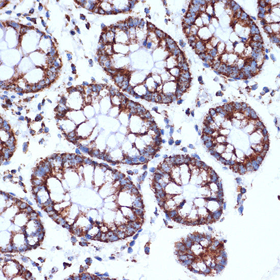 CLPP Rabbit mAb