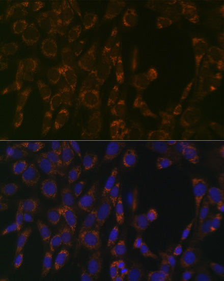 CLPP Rabbit mAb