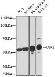 EGR2 Rabbit mAb