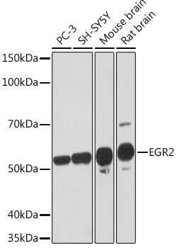 EGR2 Rabbit mAb
