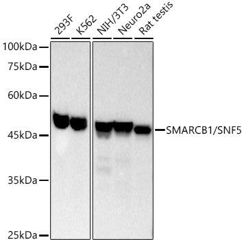 [KO Validated] SMARCB1/SNF5 Rabbit mAb
