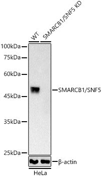 [KO Validated] SMARCB1/SNF5 Rabbit mAb