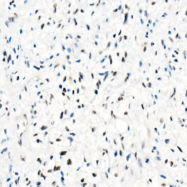 [KO Validated] SMARCB1/SNF5 Rabbit mAb