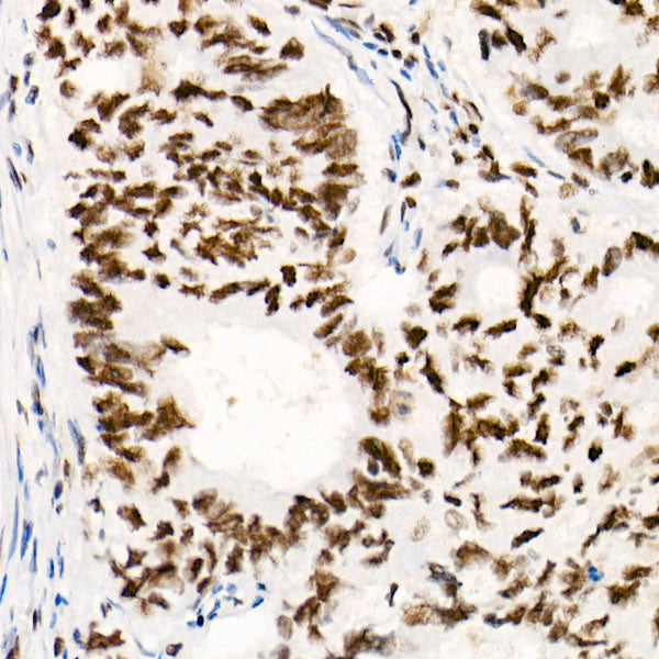 [KO Validated] SMARCB1/SNF5 Rabbit mAb