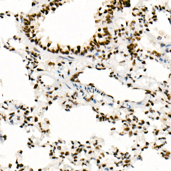 [KO Validated] SMARCB1/SNF5 Rabbit mAb