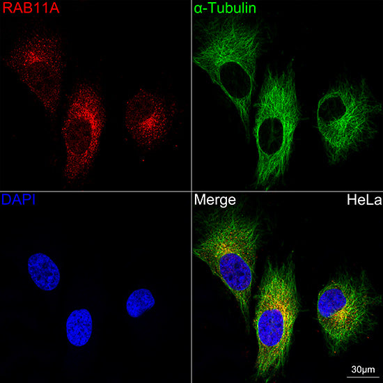 RAB11A Rabbit mAb