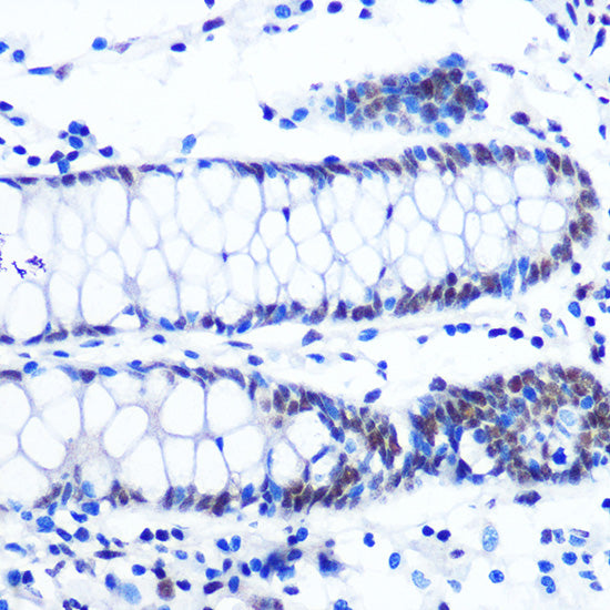 NRF1 Rabbit mAb