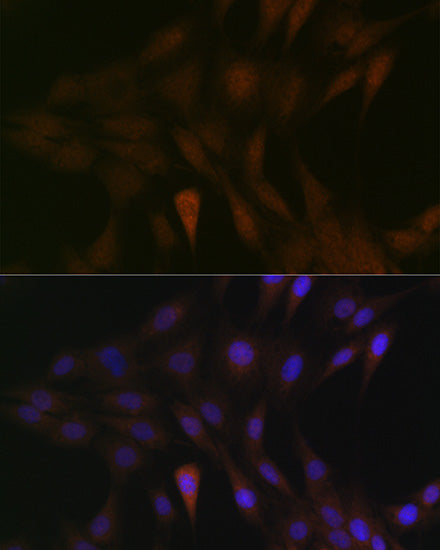 MEK3 Rabbit mAb