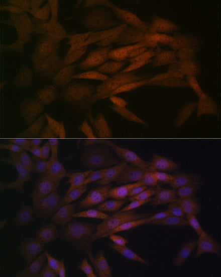 MEK3 Rabbit mAb