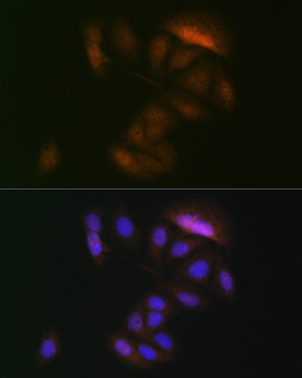 MEK3 Rabbit mAb