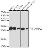 HE4/WFDC2 Rabbit mAb
