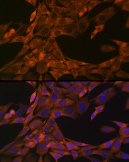 HE4/WFDC2 Rabbit mAb