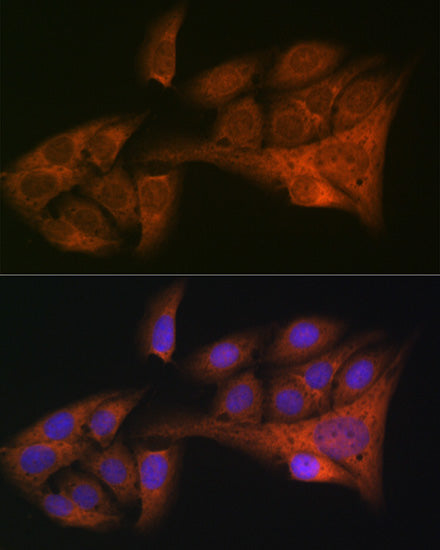 HE4/WFDC2 Rabbit mAb