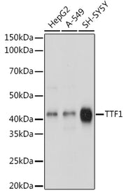 TTF-1 Rabbit mAb
