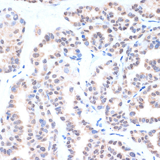 TTF-1 Rabbit mAb