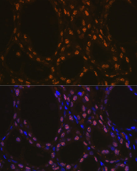TTF-1 Rabbit mAb