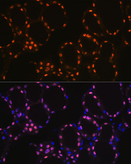 TTF-1 Rabbit mAb
