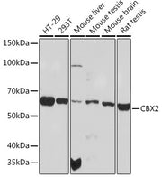 CBX2 Rabbit mAb