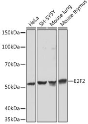 E2F2 Rabbit mAb