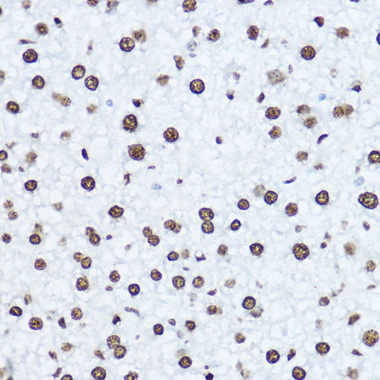 [KO Validated] Histone H1.0 Rabbit pAb