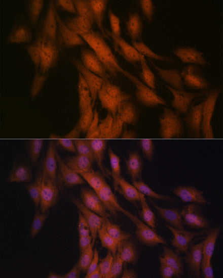 Gli3 Rabbit mAb