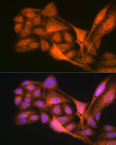 Gli3 Rabbit mAb