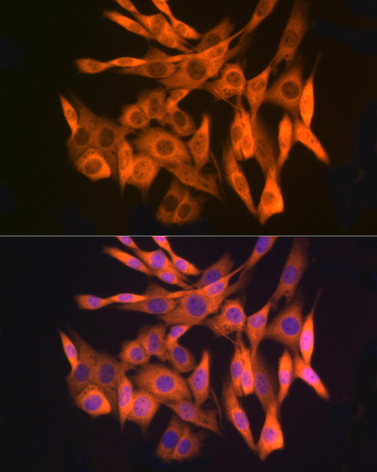 Gli3 Rabbit mAb