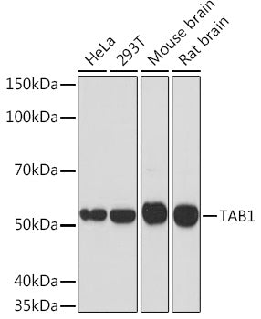 TAB1 Rabbit mAb