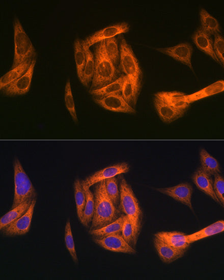TAB1 Rabbit mAb