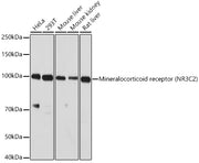 Mineralocorticoid receptor (NR3C2) Rabbit pAb