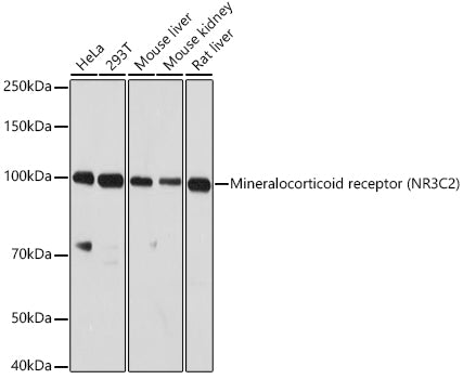 Mineralocorticoid receptor (NR3C2) Rabbit pAb