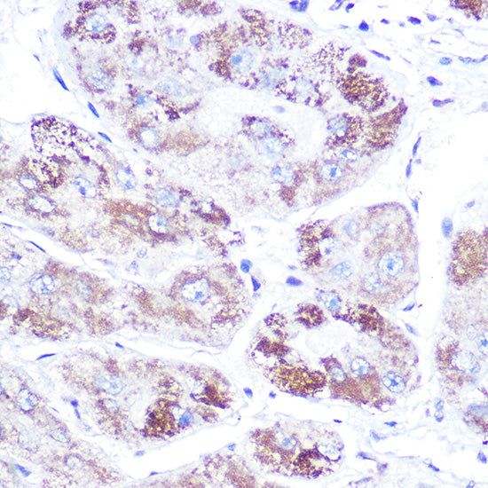 Mineralocorticoid receptor (NR3C2) Rabbit pAb