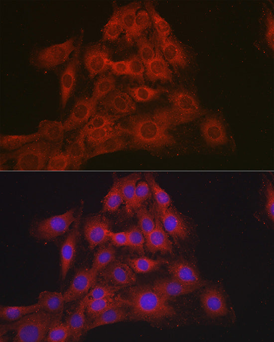 Mineralocorticoid receptor (NR3C2) Rabbit pAb